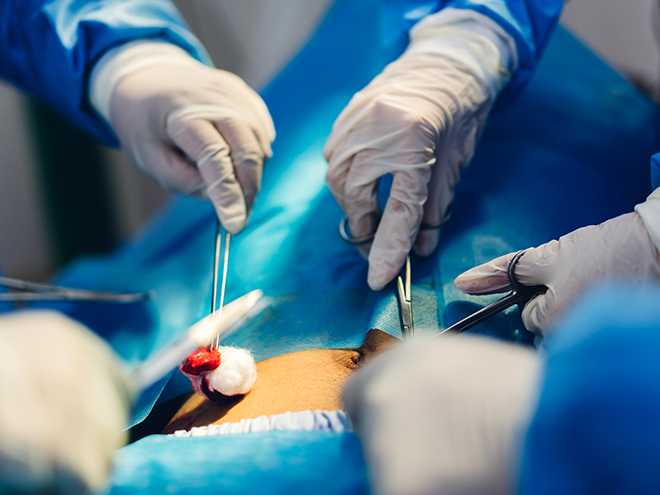 Vascular and Endovascular Surgery